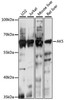 Signal Transduction Antibodies 2 Anti-AK5 Antibody CAB15424