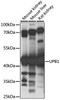 Cell Biology Antibodies 6 Anti-UPB1 Antibody CAB15452