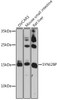 Signal Transduction Antibodies 2 Anti-SYNJ2BP Antibody CAB15469