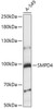 Cell Biology Antibodies 6 Anti-SMPD4 Antibody CAB15473