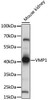 Autophagy Antibodies Anti-VMP1 Antibody CAB15523