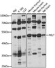 Cell Death Antibodies 1 Anti-RELT Antibody CAB15540