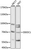 Metabolism Antibodies 1 Anti-DIXDC1 Antibody CAB15542