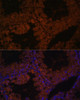 Cell Biology Antibodies 6 Anti-TPD52L3 Antibody CAB15545