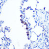 Cell Biology Antibodies 6 Anti-TOP1MT Antibody CAB15559