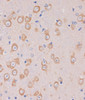 Neuroscience Anti-TRAPPC6B Antibody CAB15561