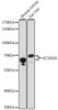 Metabolism Antibodies 1 Anti-ACSM2A Antibody CAB15563