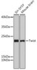 KO Validated Antibodies 1 Anti-Twist Antibody CAB15596KO Validated