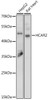 Cell Death Antibodies 1 Anti-HCAR2 Antibody CAB15611