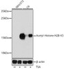 Cell Biology Antibodies 16 Anti-Acetyl-Histone H2B-K5 Antibody CAB15621