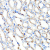 Signal Transduction Antibodies 2 Anti-RNF149 Antibody CAB15627