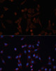 Immunology Antibodies 2 Anti-CANX Antibody CAB15631