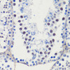 Cell Cycle Antibodies 1 Anti-CDKN1B/p27KIP1 Antibody CAB15632