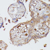 Cell Biology Antibodies 6 Anti-AGT Antibody CAB15637