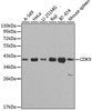 Epigenetics and Nuclear Signaling Antibodies 2 Anti-CDK9 Antibody CAB1564