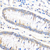 Cell Death Antibodies 1 Anti-Bax Antibody CAB15646