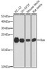 Cell Death Antibodies 1 Anti-Bax Antibody CAB15646