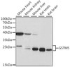 Cell Biology Antibodies 6 Anti-GSTM5 Antibody CAB15677