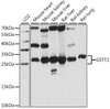 Cell Biology Antibodies 6 Anti-GSTT2 Antibody CAB15678