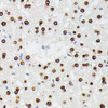 Cell Biology Antibodies 6 Anti-HNRNPD Antibody CAB15679