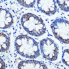 Cell Biology Antibodies 6 Anti-MAOB Antibody CAB1568