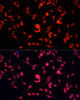 Epigenetics and Nuclear Signaling Antibodies 2 Anti-YBX1 Antibody CAB15696