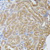 Cell Biology Antibodies 6 Anti-PPP2R5D Antibody CAB15707