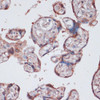 Cell Biology Antibodies 6 Anti-RPS13 Antibody CAB15720
