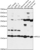 Cell Biology Antibodies 6 Anti-RPS13 Antibody CAB15720