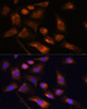 Cell Biology Antibodies 6 Anti-RPS13 Antibody CAB15720