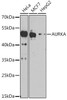 Cell Cycle Antibodies 1 Anti-AURKA Antibody CAB15728