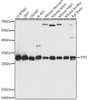 Metabolism Antibodies 1 Anti-TPI1 Antibody CAB15733