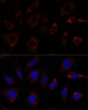 Cell Biology Antibodies 6 Anti-TBRG4 Antibody CAB15753