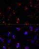 Cell Biology Antibodies 6 Anti-TBRG4 Antibody CAB15753