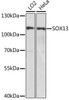 Developmental Biology Anti-SOX13 Antibody CAB15759