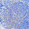 Epigenetics and Nuclear Signaling Antibodies 2 Anti-RBM39 Antibody CAB15760