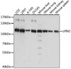 Metabolism Antibodies 1 Anti-LPIN2 Antibody CAB15762