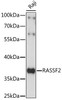 Cell Cycle Antibodies 1 Anti-RASSF2 Antibody CAB15766