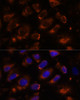 Metabolism Antibodies 3 Anti-TENM1 Antibody CAB15774