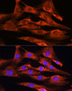 Cardiovascular Antibodies Anti-FSTL1 Antibody CAB15789