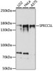 Cell Cycle Antibodies 1 Anti-SPECC1L Antibody CAB15798