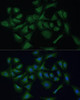 Cell Biology Antibodies 6 Anti-REXO2 Antibody CAB15808