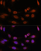 Epigenetics and Nuclear Signaling Antibodies 2 Anti-THRB Antibody CAB1582