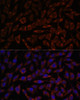 Developmental Biology Anti-BZW2 Antibody CAB15823