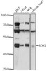 Developmental Biology Anti-BZW2 Antibody CAB15823