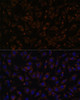 Signal Transduction Antibodies 2 Anti-PLLP Antibody CAB15834