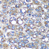 Cell Biology Antibodies 6 Anti-TIMMDC1 Antibody CAB15839