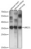 Signal Transduction Antibodies 2 Anti-UBE2J1 Antibody CAB15841