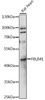 Cell Biology Antibodies 6 Anti-FBLIM1 Antibody CAB15850