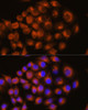 Cell Biology Antibodies 6 Anti-ADORA2A Antibody CAB1587